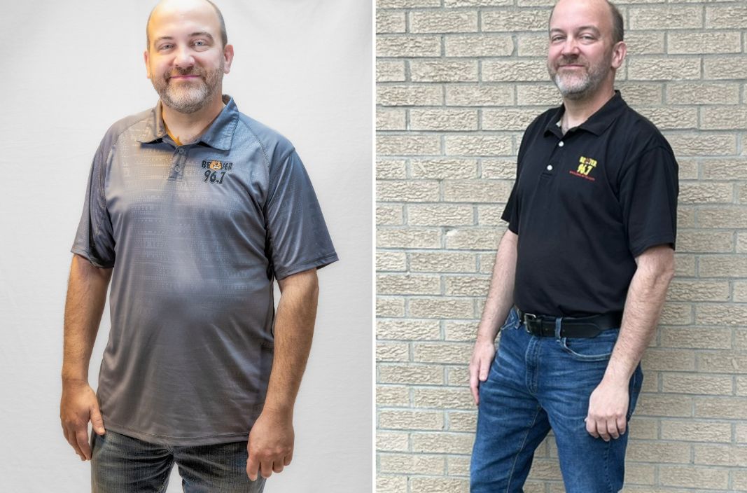 Bowling Green Weight Loss Bowling Green Loss Clinic